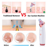 Blackhead Suction Facial Washing Instrument