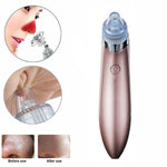 Blackhead Vacuum Pore  Cleaner , Acne Pimple Remover