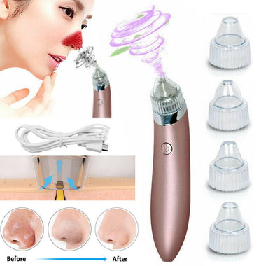 Blackhead Vacuum Pore Cleaner & Acne Remover | Happysoul